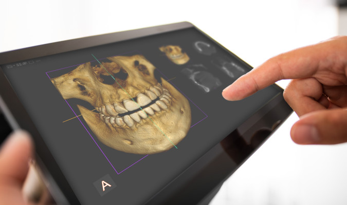 3D Imaging