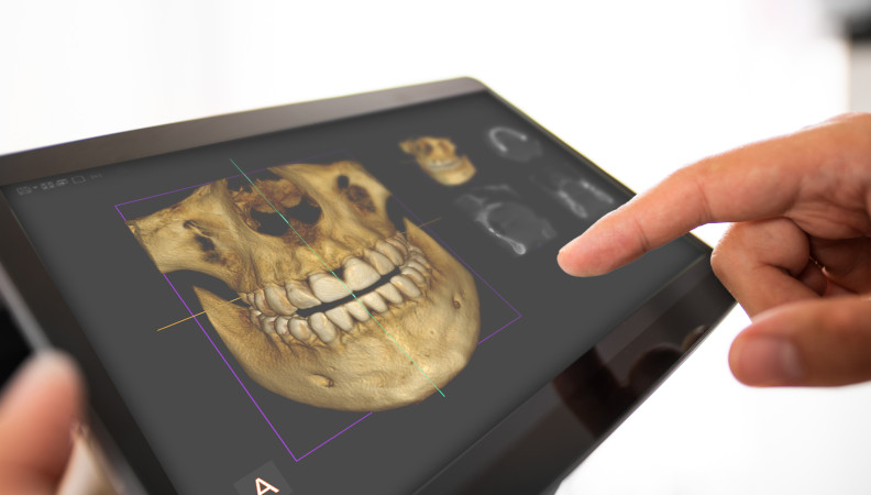 3D High-Definition Radiographic Imaging | Masterpiece Smiles Orthodontics