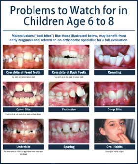 Orthodontic problems to watch for young children